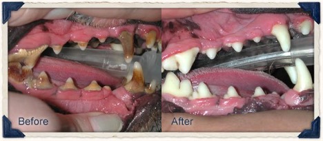 before and after pictures of professional dental cleaning